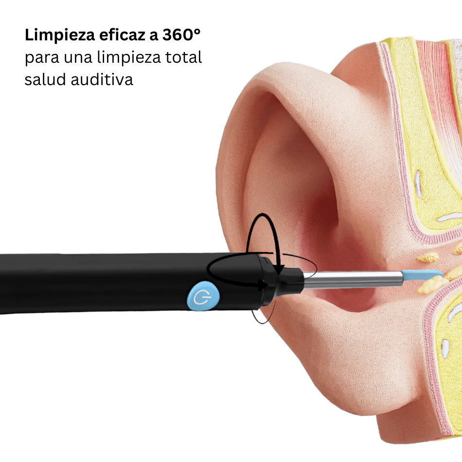 EARLUX™ - Limpiador de oídos inteligente con la nueva tecnología SmartClean